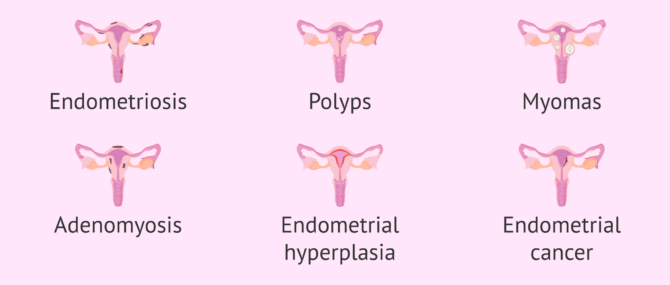 Pathologies Affecting The Endometrium