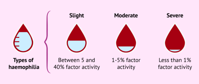 Types Of Haemophilia According To Their Severity