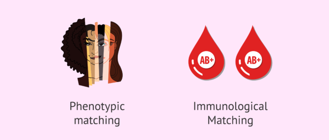 Imagen: Phenotypic and immunological matching between donor and recipient