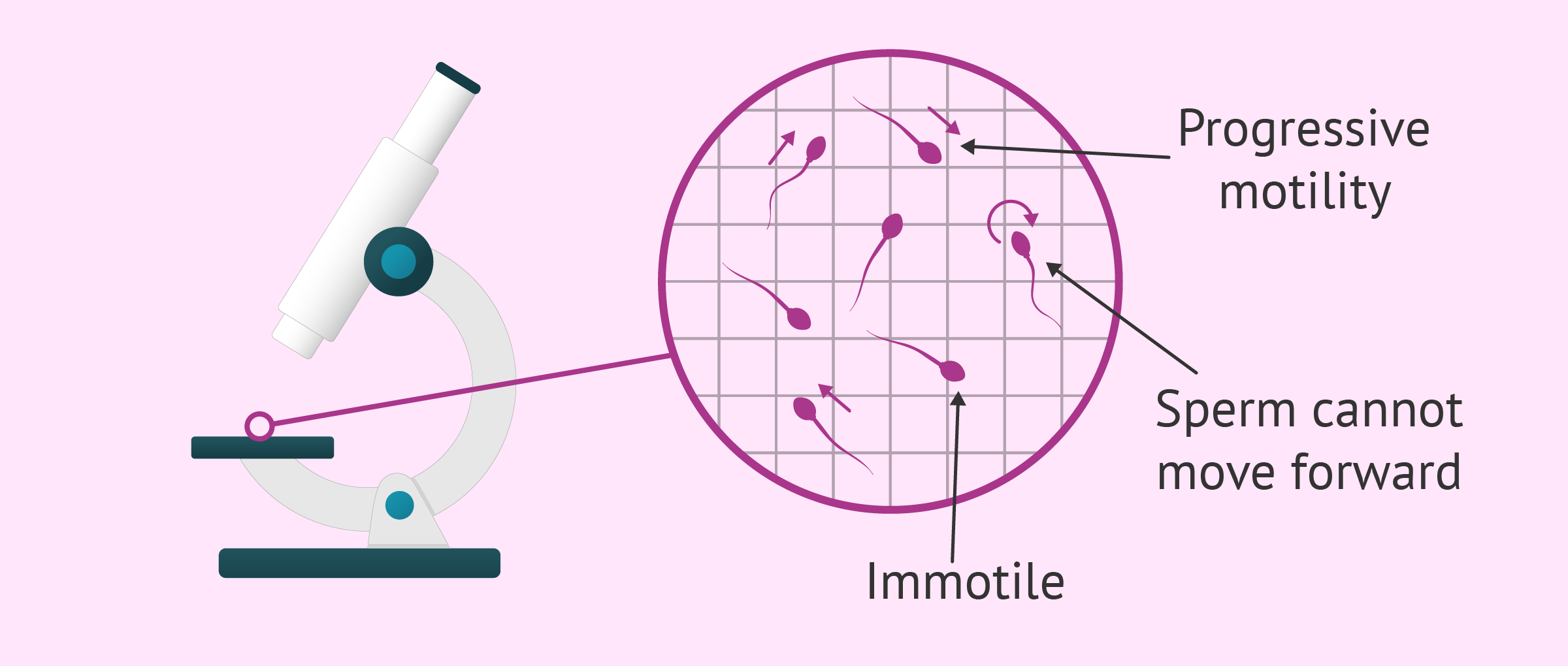 Assessment Of Sperm Motility