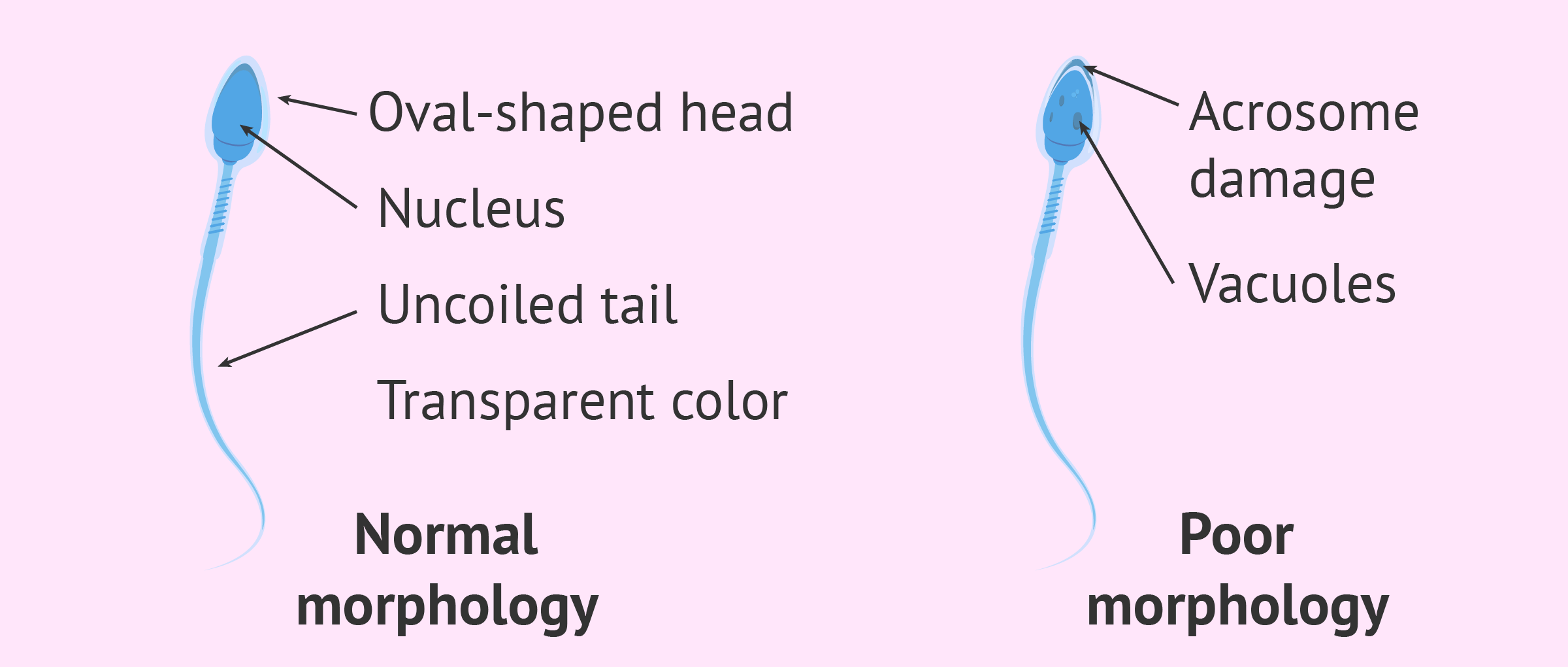 Characteristics Of Normal Sperm Morphology