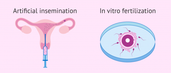 main-assisted-reproduction-methods