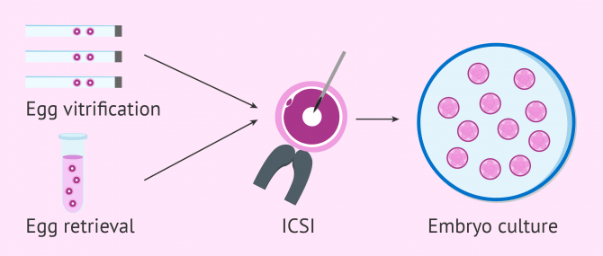 Ovarian response