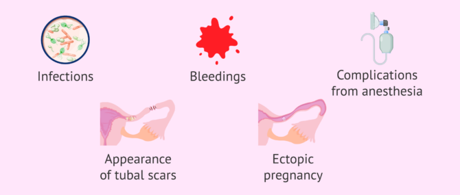 Imagen: Risks of tubal recanalization