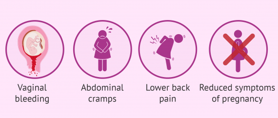 Symptoms Of Threatened Miscarriage