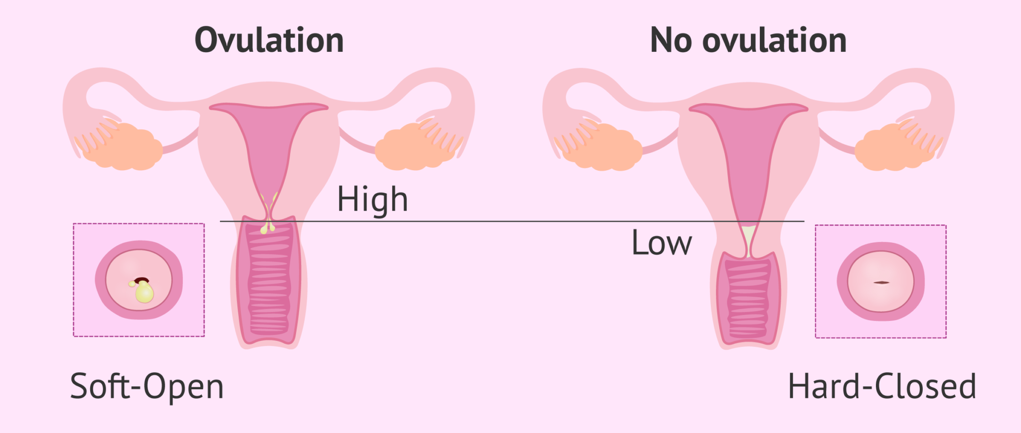 changes-in-the-cervix-during-the-menstrual-cycle