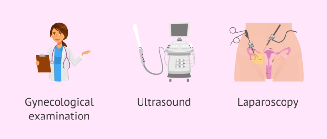 Imagen: Diagnosis of possible causes of menstrual pain