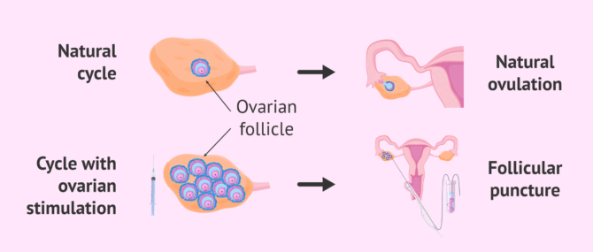 Natural and stimulated cycle in women