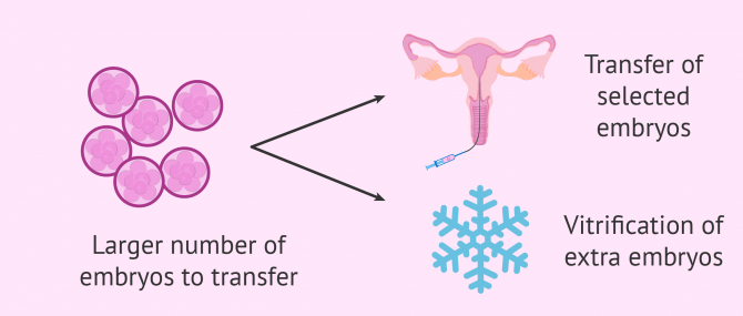 Imagen: Pros of day 3 embryo transfers