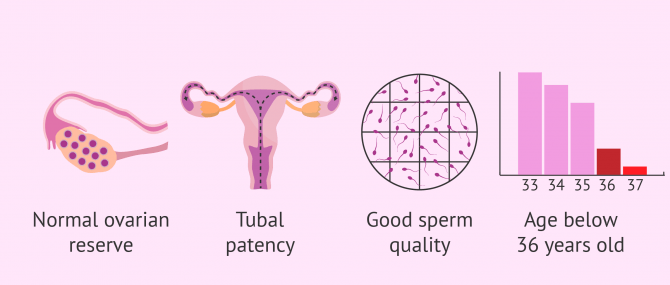 Imagen: Requirements for couples to undergo intrauterine insemination