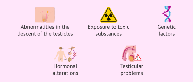 Causes of secretory azoospermia