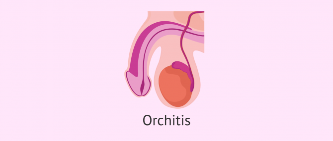 What is orchitis?