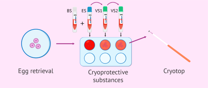 Imagen: Egg vitrification process