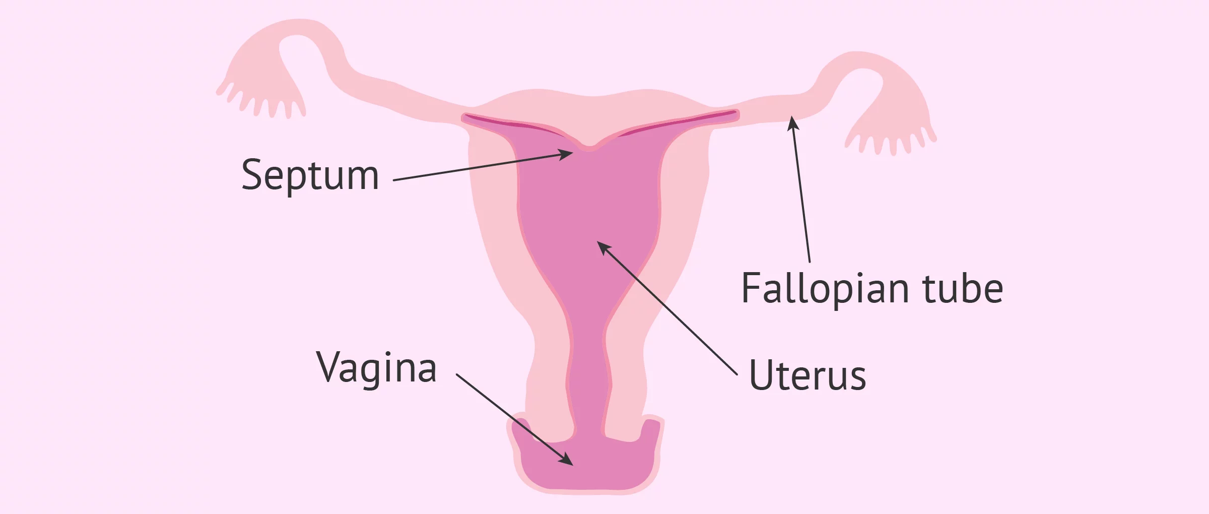 Arcuate uterus diagram