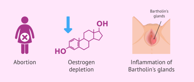 Imagen: What are the physiological causes of vaginismus?