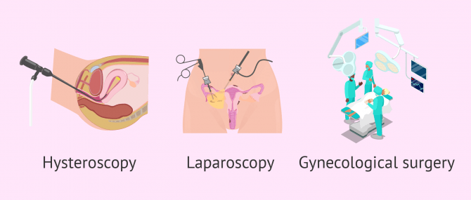 Surgical procedures for uterine anomalies