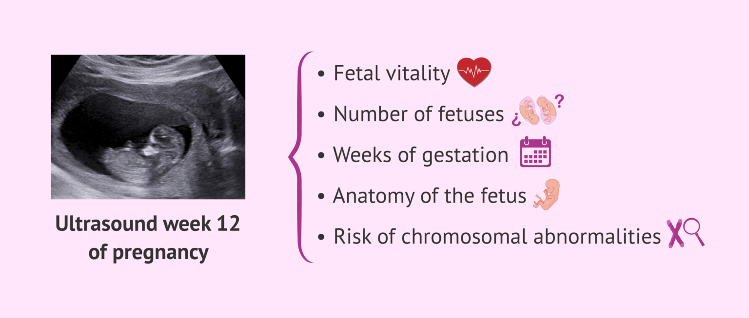 12-week-ultrasound-scan