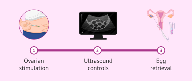 Imagen: Requirements to carry out an IVF with double donation