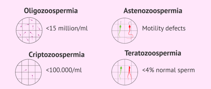 Imagen: Changes in the semen