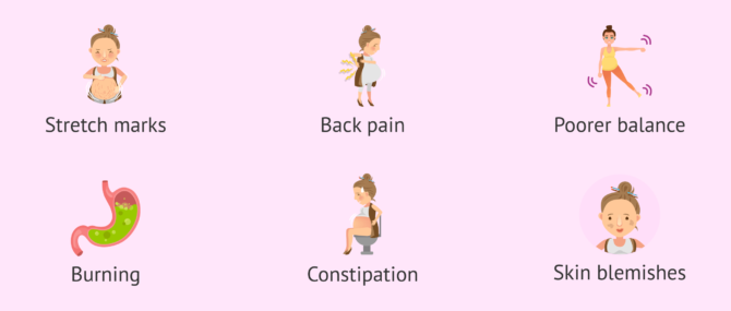 Imagen: Discomfort and symptoms in week 24 of pregnancy