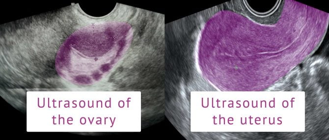 Imagen: Baseline ultrasound study