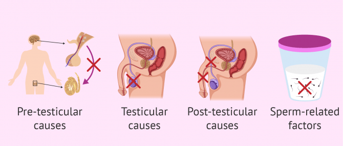 Imagen: Main Causes in Male Sterility