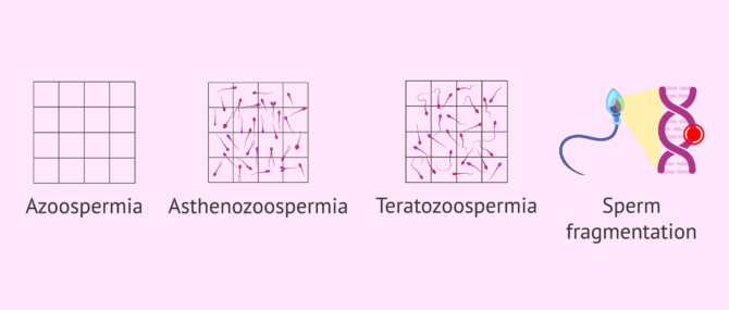 Imagen: Consequences of seminal infections on male fertility