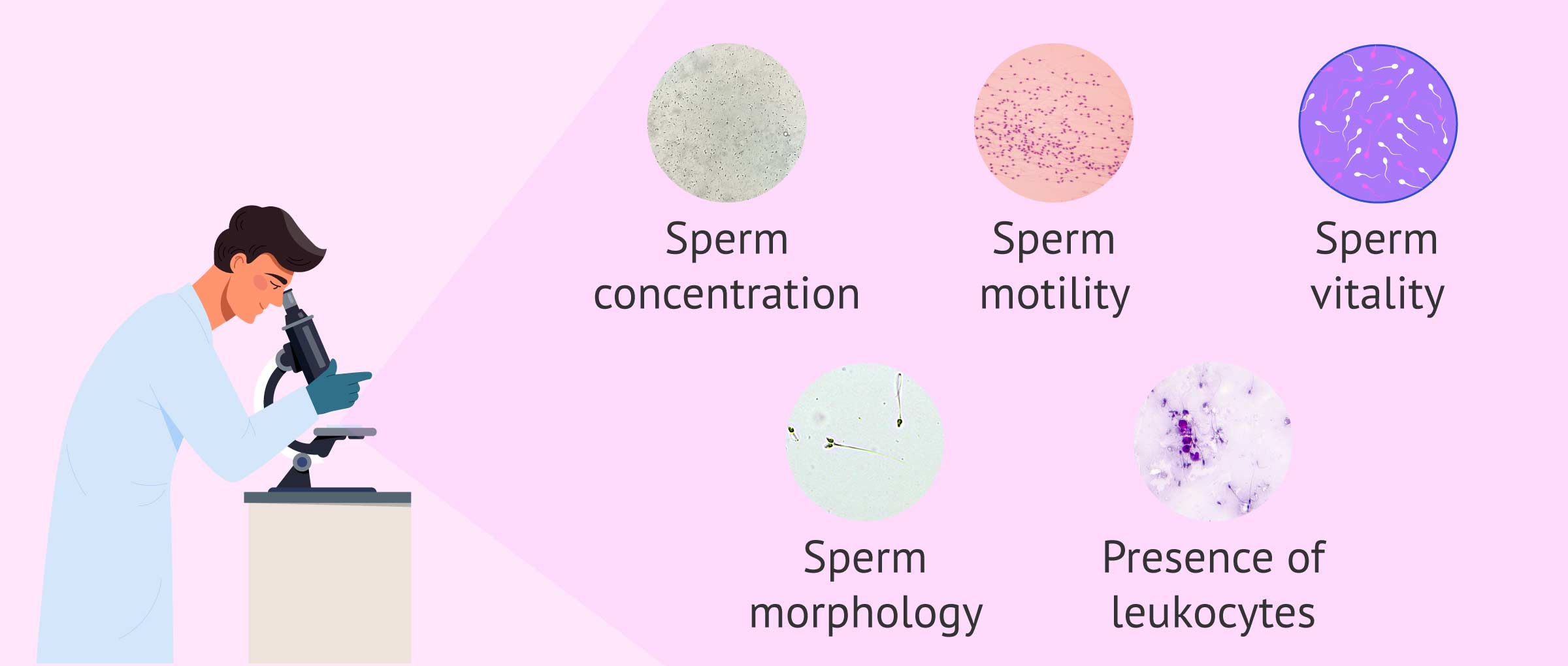 Sperm Test Results Explained - Interpretation & Normal Values