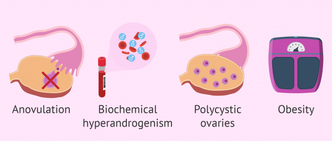 PCOS symptoms