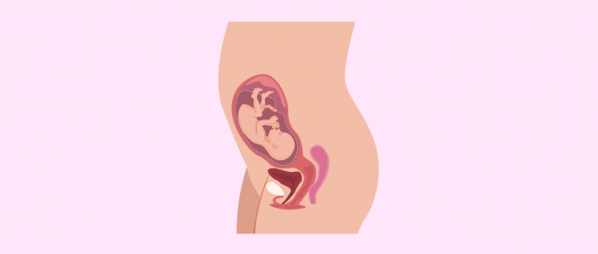 Imagen: Completely developed fetus at month 7