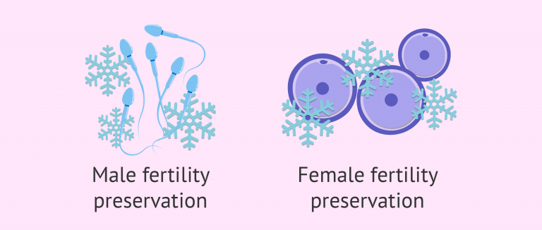 preserving-male-and-female-fertility