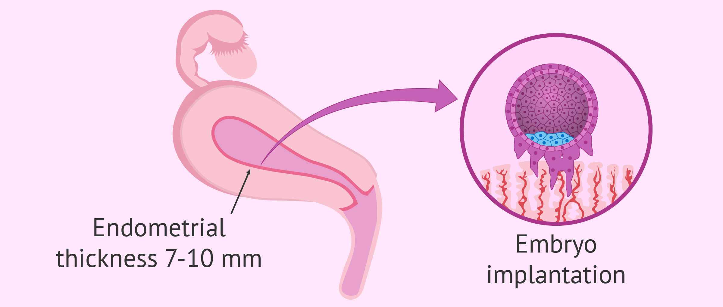 Endometrial Receptivity And Embryo Implantation