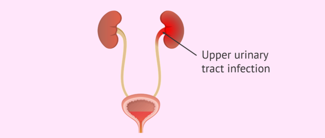 Imagen: Liquids and urinary infections