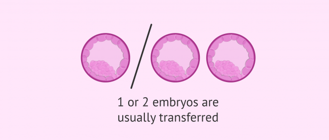 Imagen: Transfer of 1 or 2 embryos