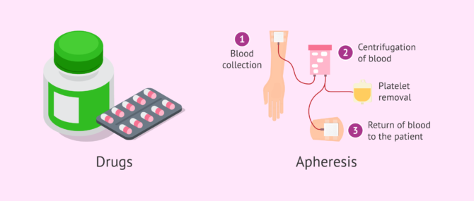 Imagen: Therapeutic options for excess platelets