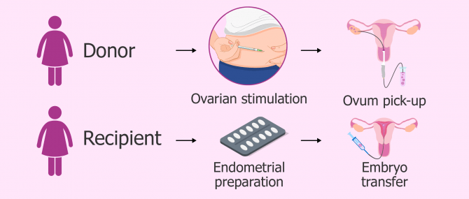 Imagen: Synchronizing egg donor and recipient