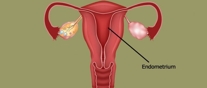 Reception-ready phase of the endometrium for embryo transfer