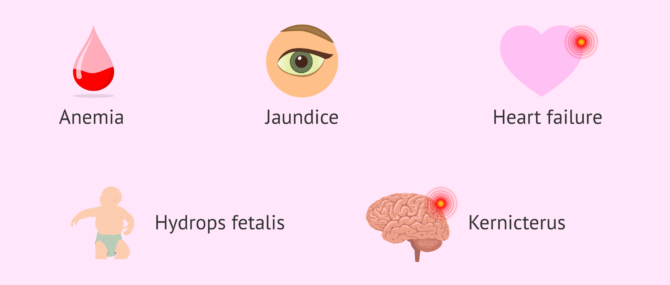 Imagen: Symptoms of perinatal haemolytic disease