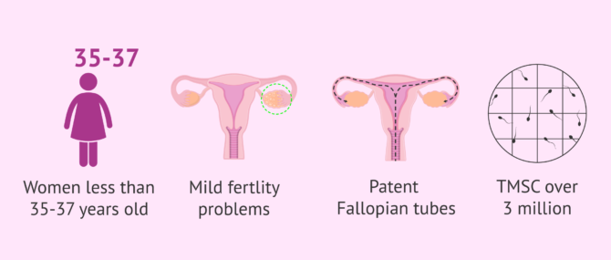 Imagen: Factors for choosing to perform intrauterine insemination