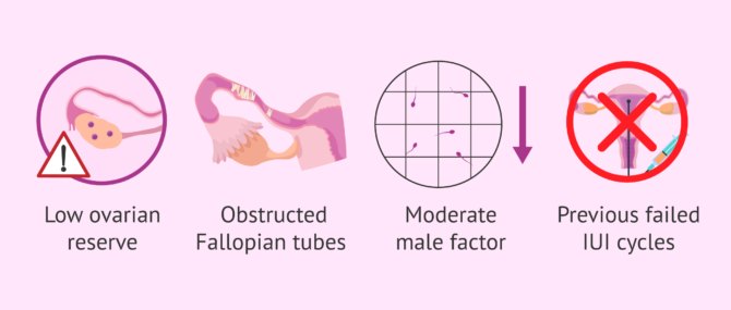 Imagen: Factors for choosing treatment with IV