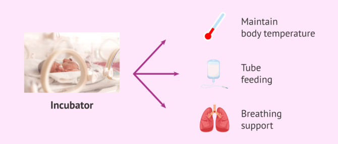 Imagen: How are premature babies cared for?