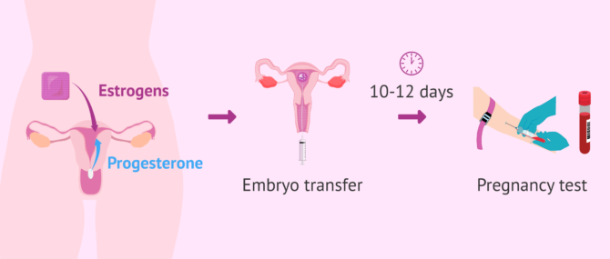 Imagen: Process for the recipient in ovodonation