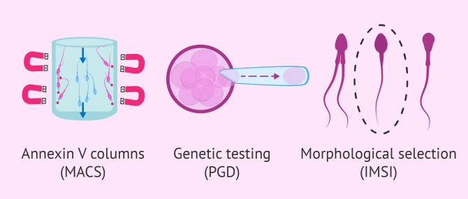 Additional techniques in IVF ICSI procedures