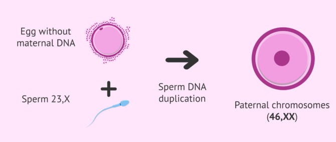 Imagen: Complete hydatidiform mole