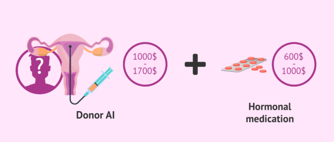 Imagen: How much does donor IUI cost?