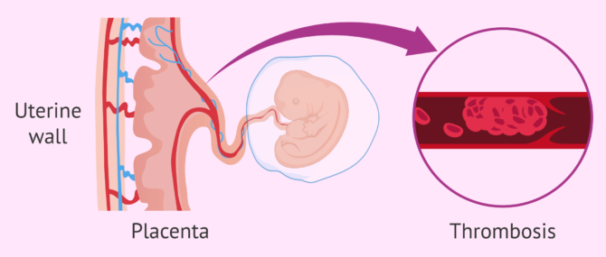 Imagen: What is the blood coagulation study like?