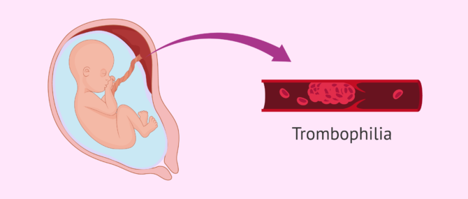 Imagen: Thrombophilia, a pathology that affects blood clotting