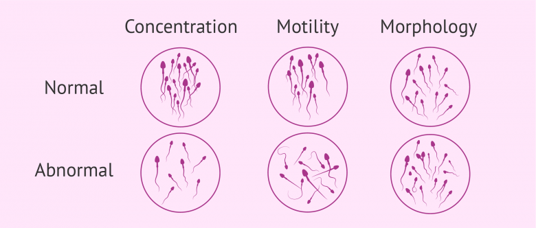 semen-analysis-microscopic-examination