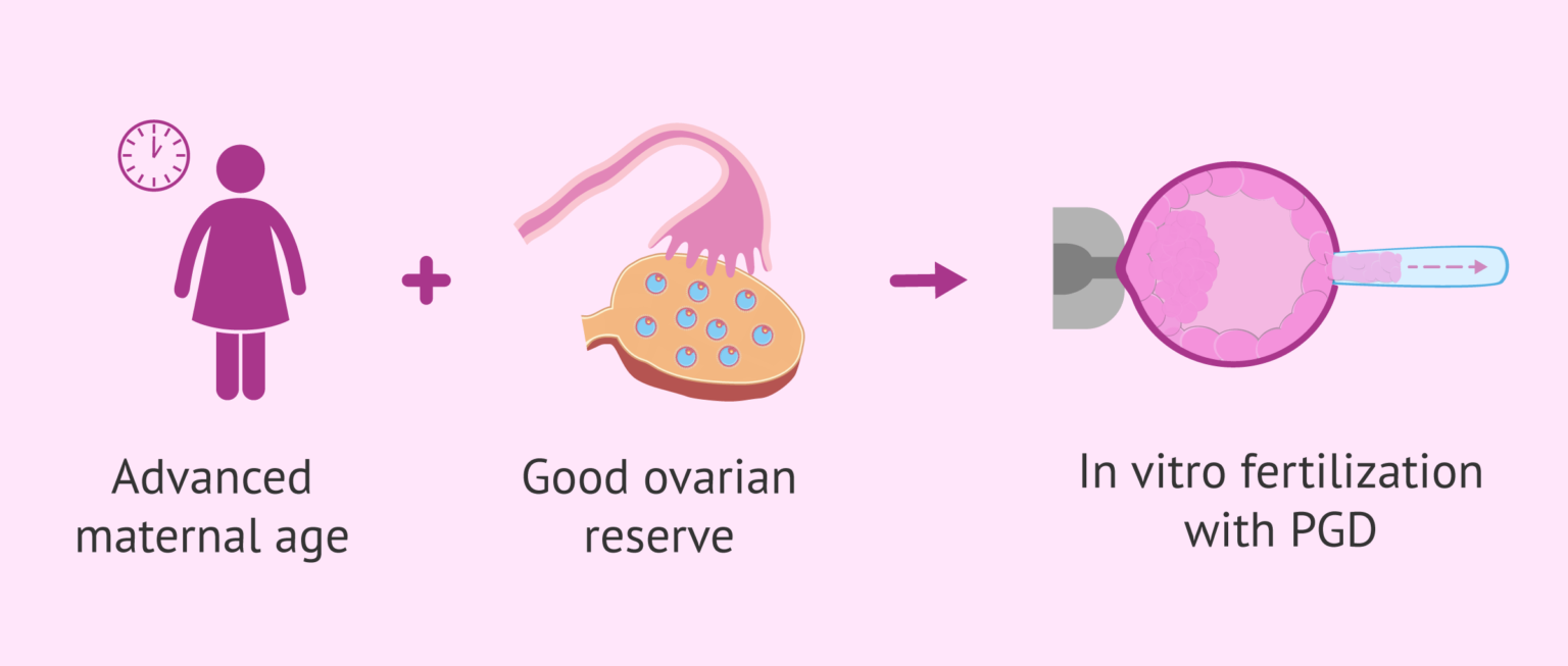 ivf-with-pgd-in-elderly-women