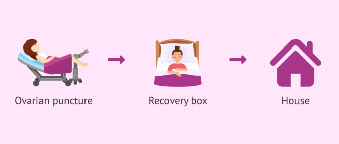 Imagen: Recovery from anaesthesia after follicular puncture